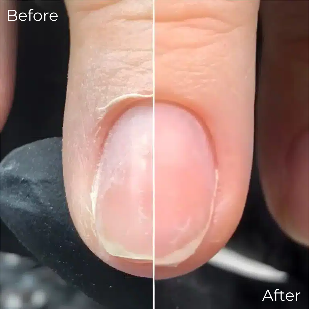 Organic Nail Growth Cuticle Oil – Nourishing Cuticle & Nail Care | Mana Beauty Lab